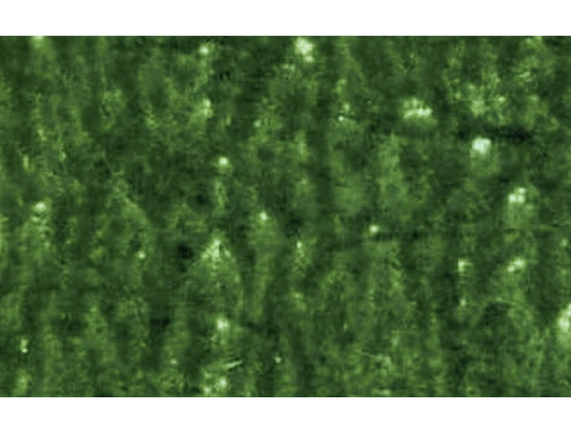 Flexo-Printing-Defects-of-Mottled Image การพิมพ์เฟล็กโซ-ข้อบกพร่อง-ของ-ภาพจุดด่างดำ
